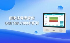 超聲骨密度儀一體機可觸屏
