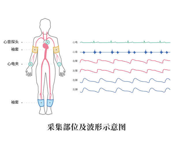 動脈硬化檢測儀產品應用
